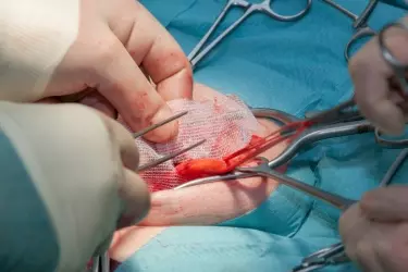 best hospital for hernia repair surgery in Katihar, best doctor for hernia treatment in Katihar, cost of hernia surgery in Katihar